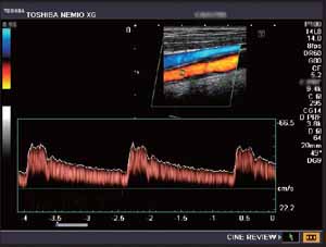 Ultraschall Bild Ultraschall Bild