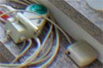 Dental Ultraschall Dental Ultraschall