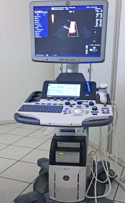 Ultrasound Ultraschall gerät